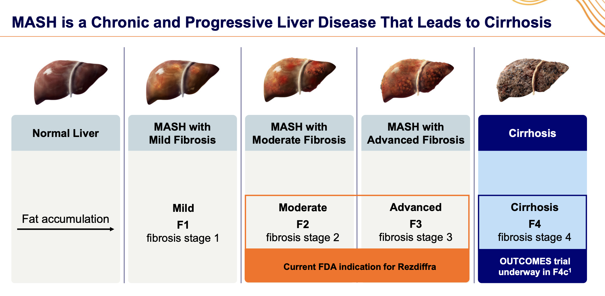 Stages of the disease MASH